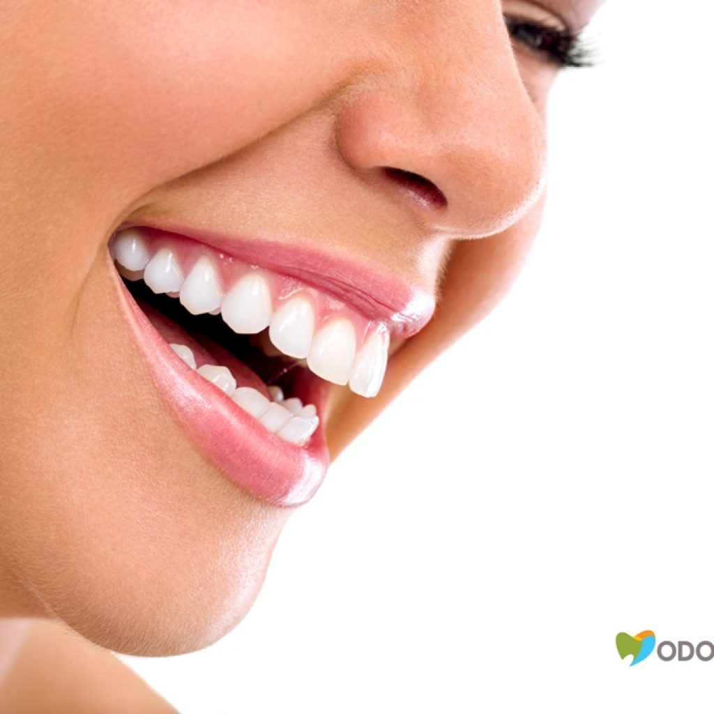 clareamento-dental-clinica-odontomania