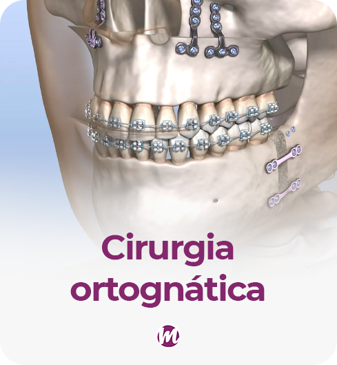 cirurgia