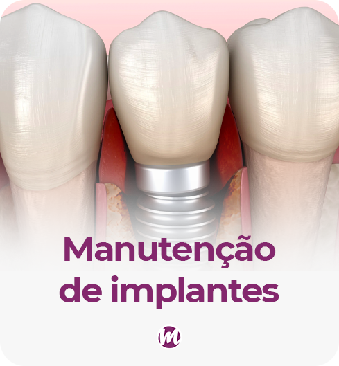 manutenção