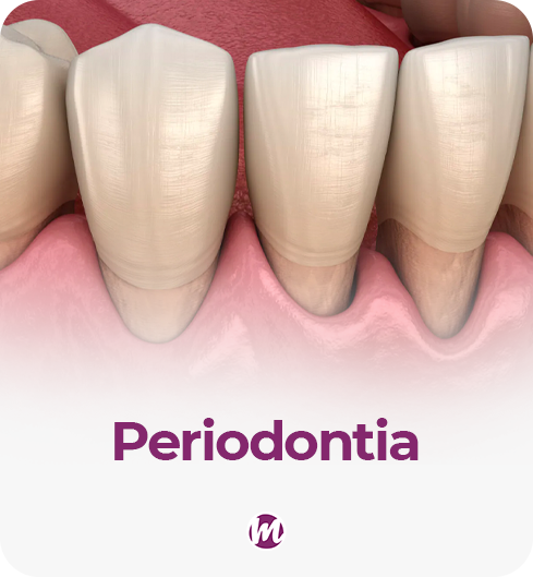 periodontia