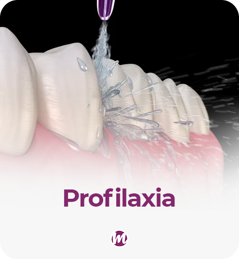 profilaxia