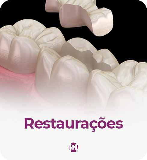 restaurações