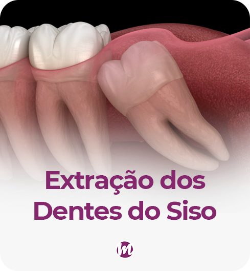 sisos