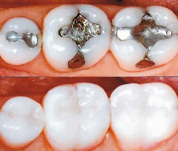 odontologia-estetica-cor