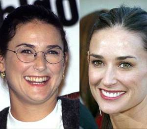 demi-before-and-after