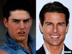 tom-cruise-before-after1