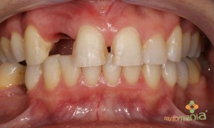 Foto3