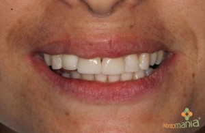 Foto5