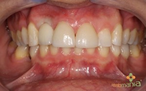Foto6