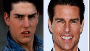dentes