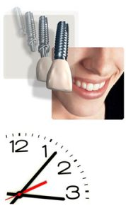 implante-dentario-no-mesmo-dia