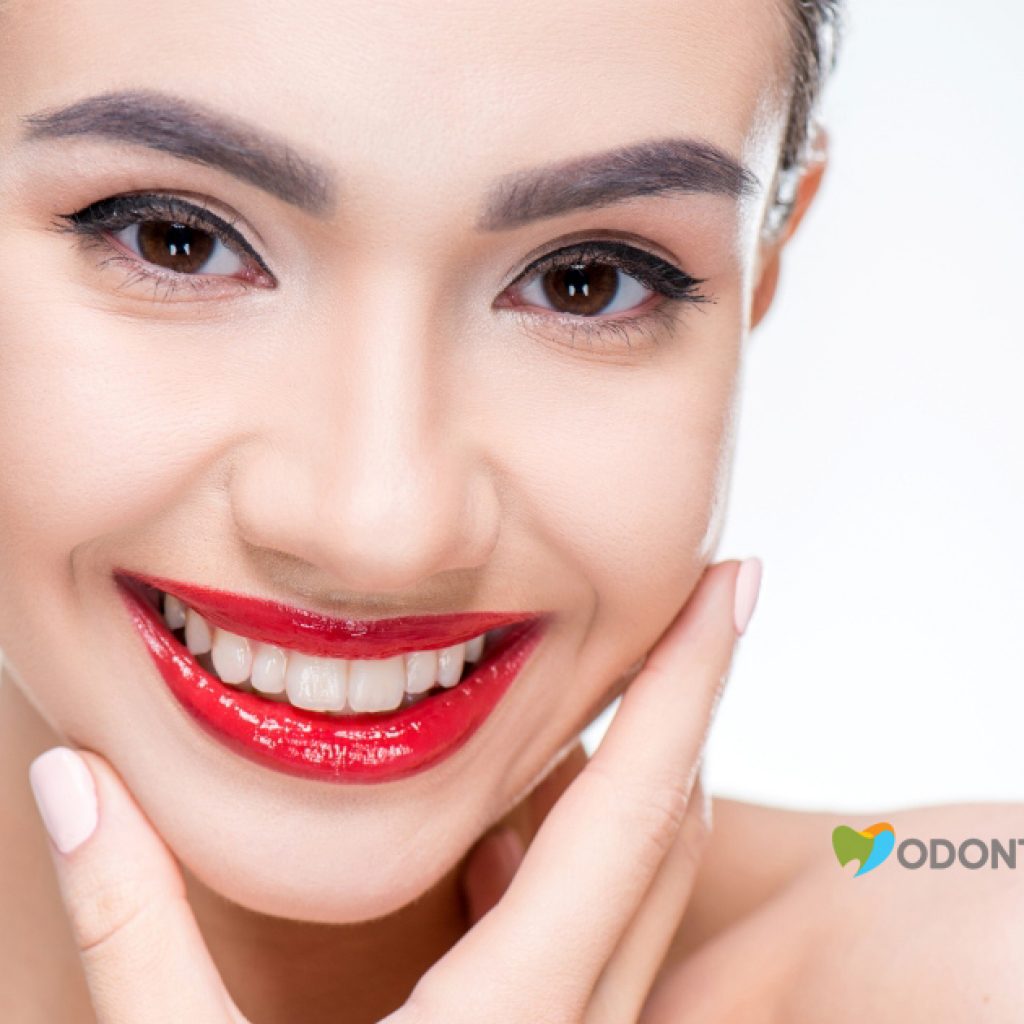 o-que-e-lente-de-contato-dental-clinica-odontomania