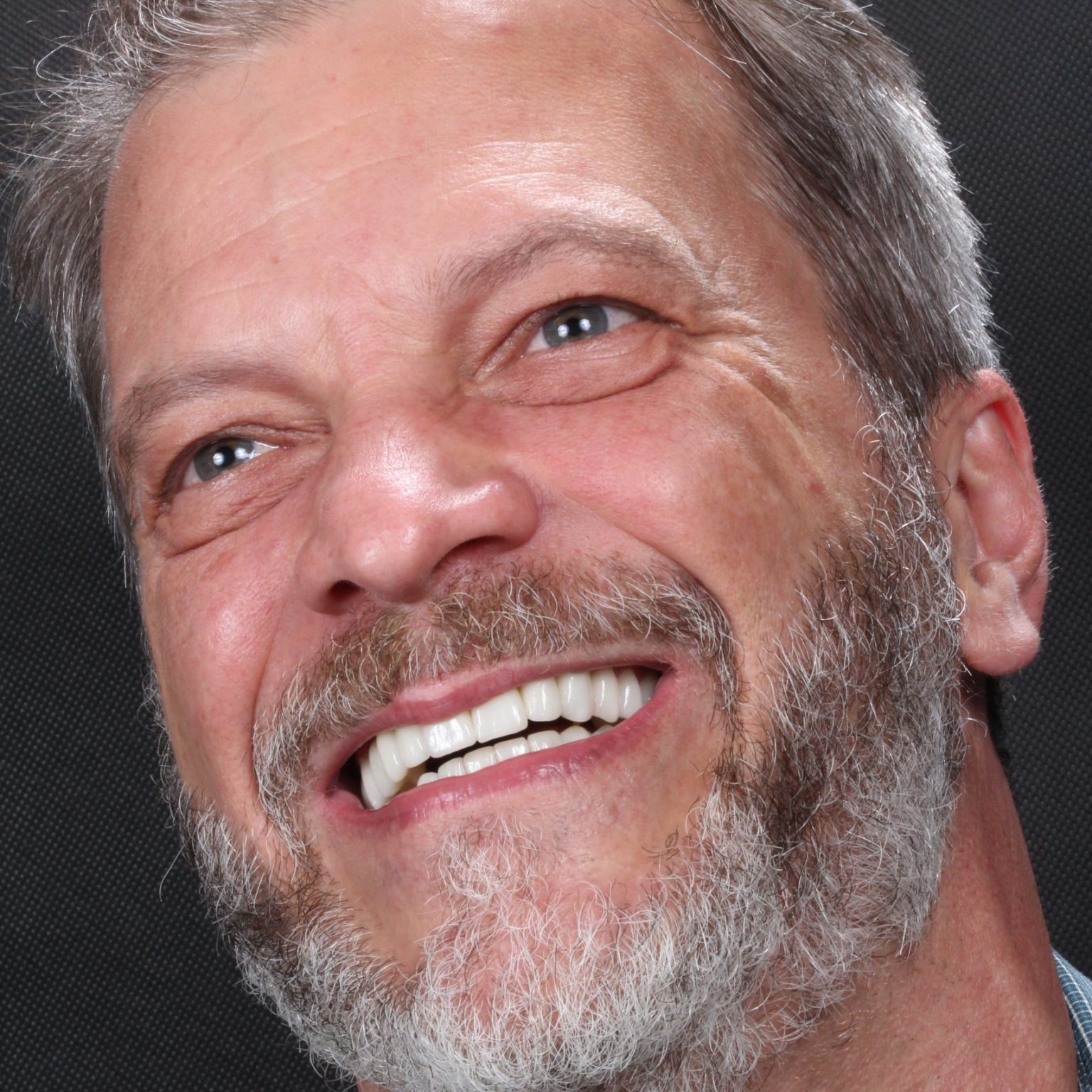 implantes-dentarios-clinica-odontomania-sao-paulo-sp54